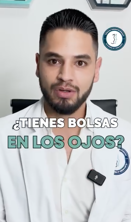 Bolsas en los ojos