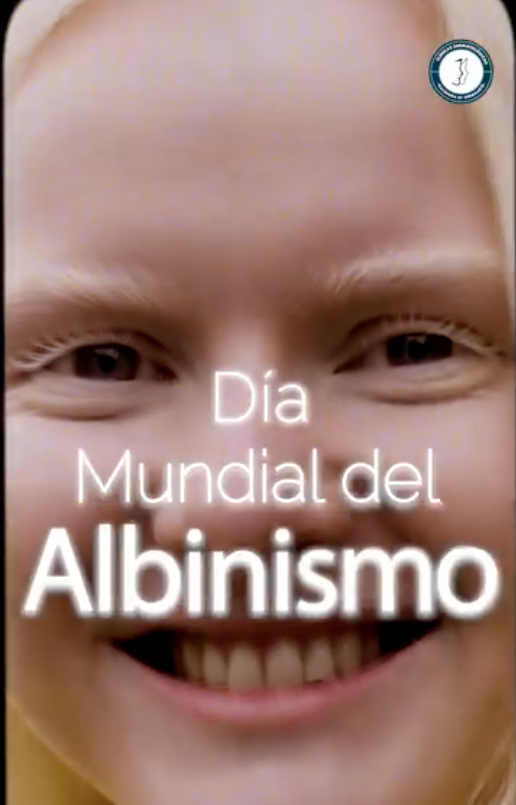 Día del Albinismo 'Voz con IA'