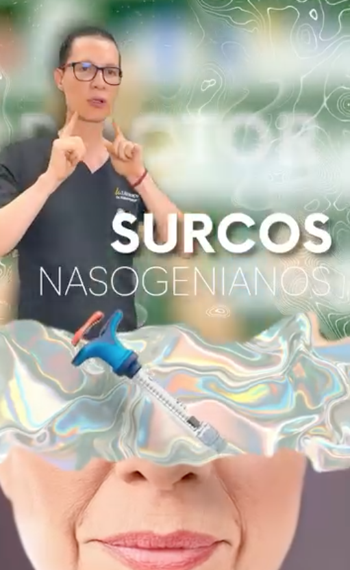 Reel Surcos 